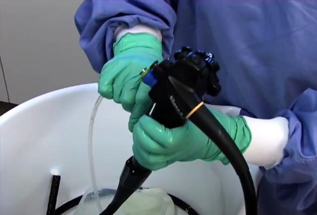 Endoscope Cleaning